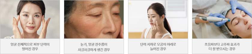 시술대상