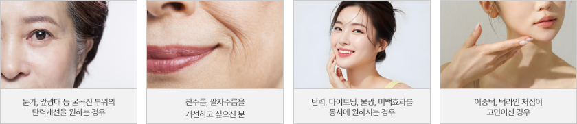 시술대상